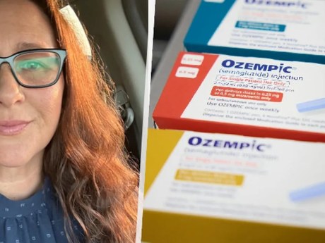 Únavu a bolesti přičítala Ozempicu, v těle jí rostl nádor