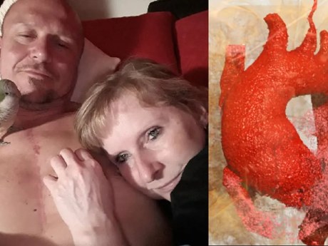Partnerka zaslechla podivný tep: Jiřímu odhalili výduť aorty