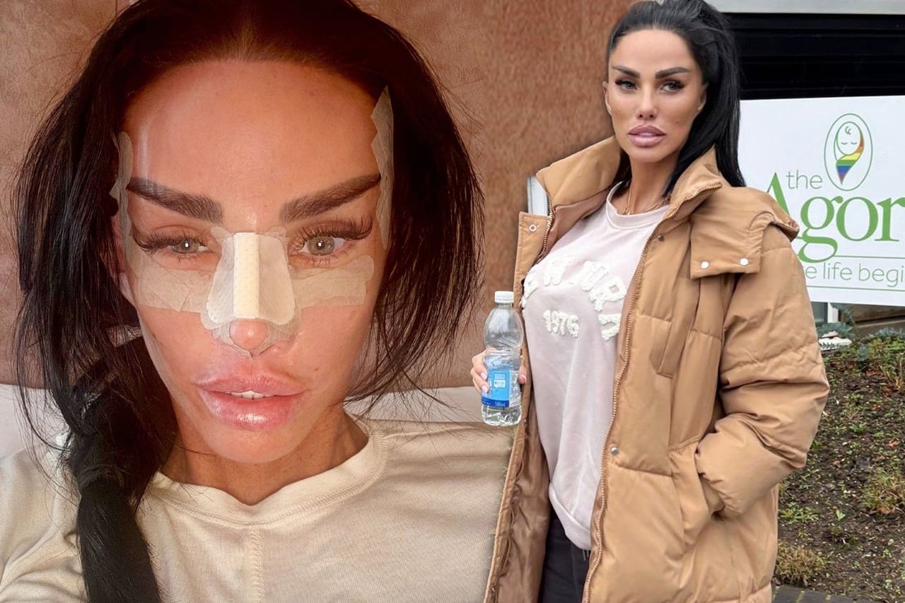 Denise Richards po liftingu za 5,6 milionu čelí tvrdé kritice